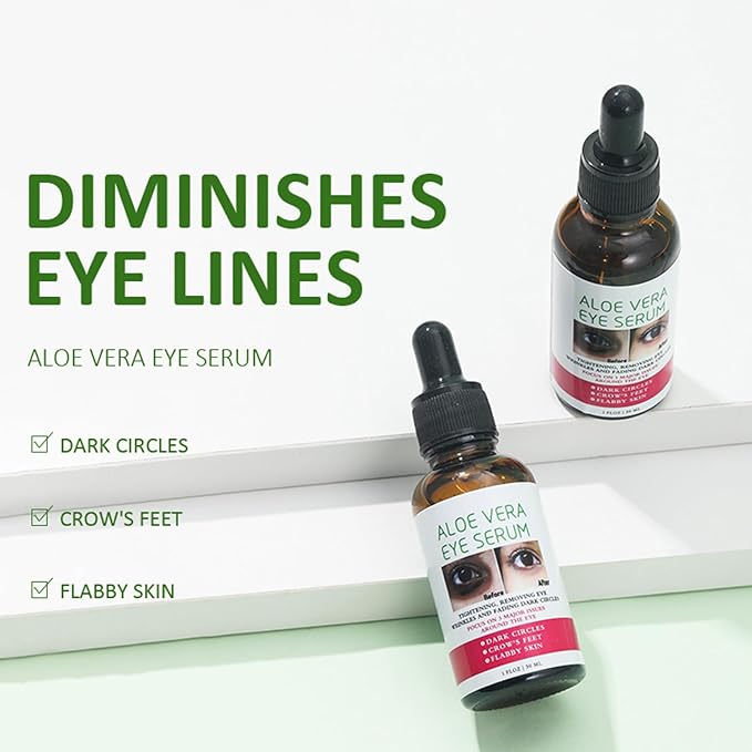 Aloe Vera Eye Serum for Dark Circles,Deeply Moisturizing,Anti Aging, Smooth Fine Lines and Crows Feet,Tightening and Lifts Eye Skin,Enhance Skin Elasticity,Fragrance Free(1 OZ)