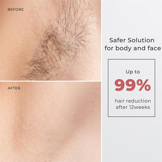 Laser Hair Removal for Women and Men, IPL with Ice-Cooling System for Nearly Painless And Long-Lasting Result At-Home Permanent Hair Removal Device 999999 Flashes for Whole Body Use