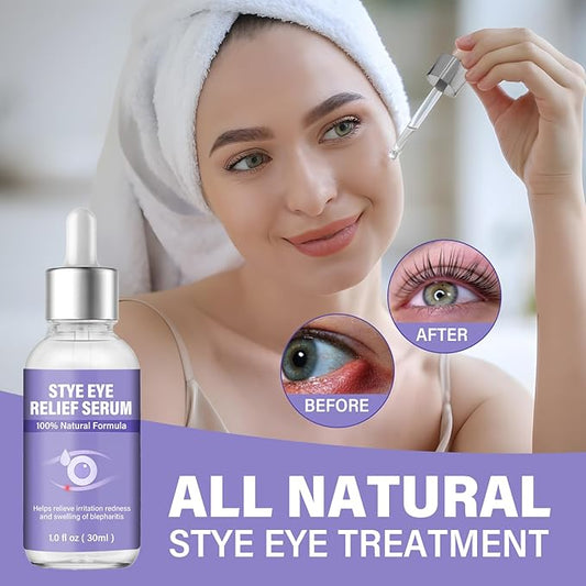 Stye Eye Treatment, Natural Stye Relief Serum, Gently Cleanses Lashes and Eyes, Chalazion and Blepharitis Treatment,Relieves Eye Irritation
