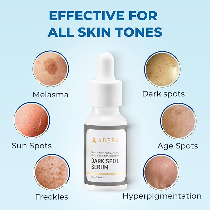 Abera Dark Spot Serum for Face, Dark Spot Corrector, Melasma & Age Spot Treatment, Boost Moisturization & Pore Minimize, All Skin Types, 0.68 fl Oz