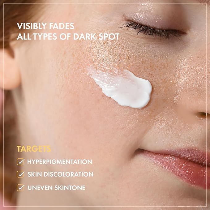 8 Days Spot Cream, Dark Spot Remover for Face, Age Spot, Sun Spot, Freckles, Melasma, Brown Spot Serum, Advanced Formula Corrector Cream with Niacinamide for Women and Men, 50g, 1.76 oz.