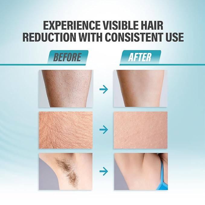 Herbishh IPL Laser Hair Removal Device, Painless Cooling Technology- 400,000 Flashes, Hair Removal Machine with 5 Intensity Levels, Skin Sensor & Dual Flash Modes- Manual & Auto, For Face & Body, Gray