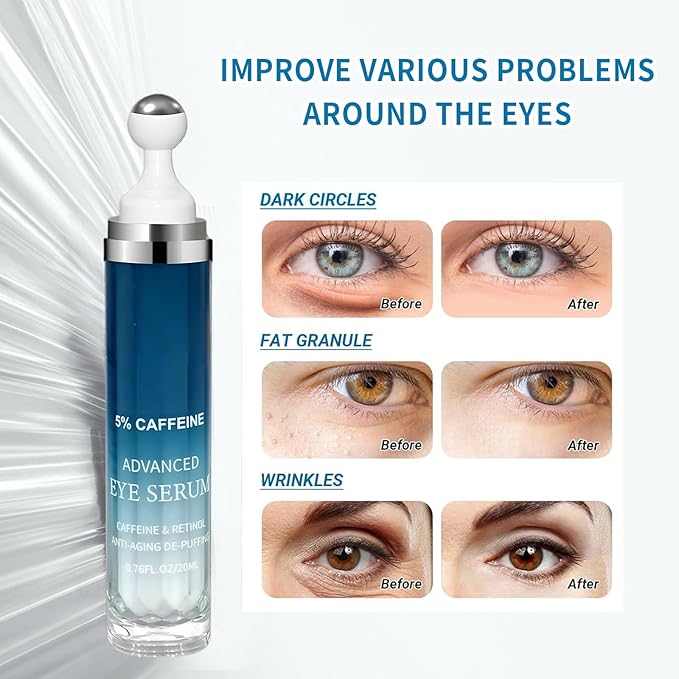 5% Caffeine Eye Serum for Dark Circles,Under Eye Cream with 360°Eye Roller for Eye Bags & Puffiness- Eyes Treatment Serum for Women Create a Natural Charm for Your Eyes(0.76 fl. oz.)