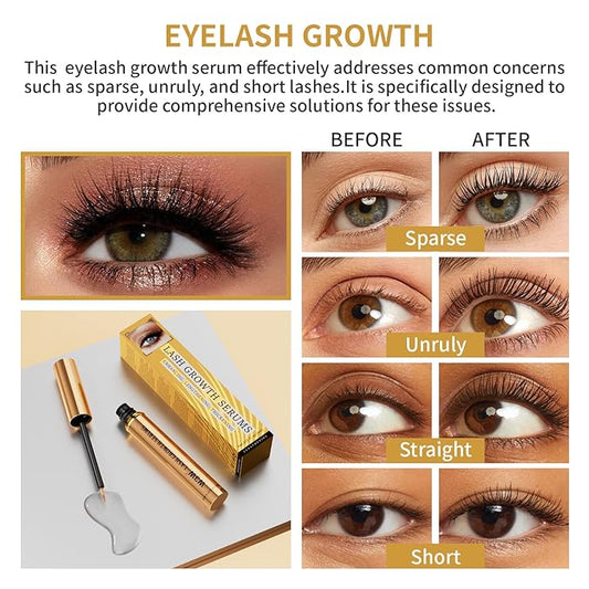 Lash Serum - Eyelash Growth Serum for Longer, Fuller, Thicker Lashes - Gentle Formula, 4ml