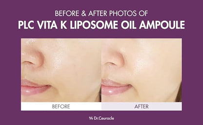 Dr.Ceuracle PLC Vitamin K Liposome Oil Ampoule - Korean Vitamin K Face Serum for Evening Skin Tone and Relieving Imperfections (50 ml / 1.69 fl. oz.)