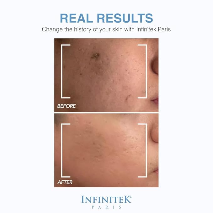 Infinitek Paris Skin Care Organic Facial Hyaluronic Acid Serum - 1 Fl Oz, Hydrating Face Serum - Premium Anti-Aging Moisturizer Hyaluronic Acid with Organic Silicon for Radiant Skin