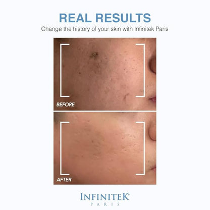 Infinitek Paris Skin Care Organic Facial Hyaluronic Acid Serum - 1 Fl Oz, Hydrating Face Serum - Premium Anti-Aging Moisturizer Hyaluronic Acid with Organic Silicon for Radiant Skin