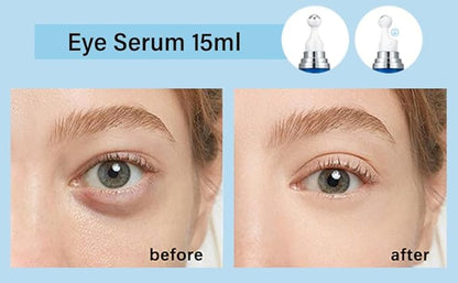 5% Caffeine Eye Serum, Anti-Aging Hydrating Eye Serum with 360° Massage Ball,Caffeine Eye Roller Reduce Wrinkles and Fine Lines,Under Eye Roller Cream for Dark Circles and Puffiness