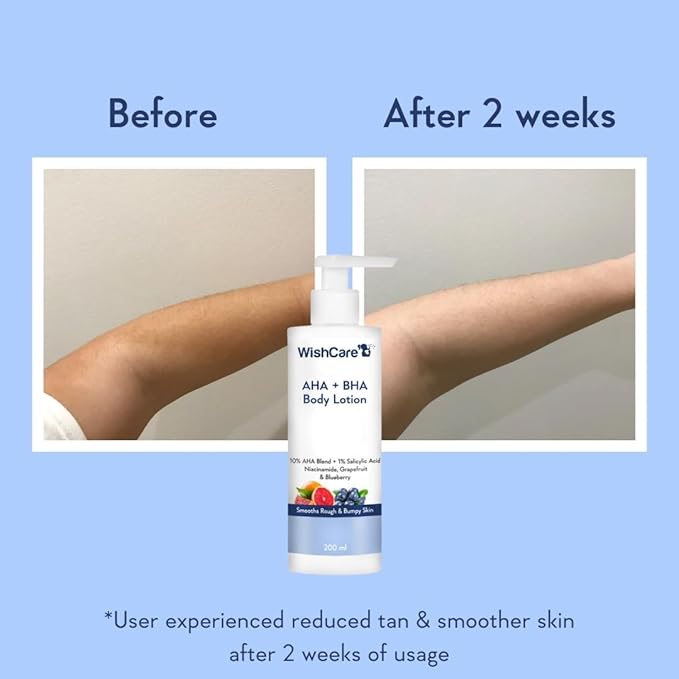 10% AHA + 1% BHA Body Lotion for Men & Women - Body lotion for dry skin - Detans, Smooths Rough & Bumpy Skin 200ml