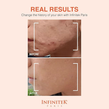 Infinitek Paris Vitamin C Face Serum - Hydrating and Brightening Antioxidant Skincare with Green Tea and Ginseng - Premium Vitamin C Facial Serum with Hyaluronic Acid for Radiant Skin and Anti Aging