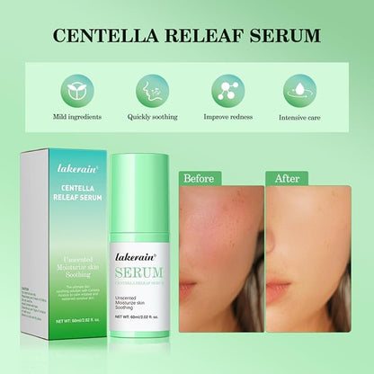 NICEFACE Centella Releaf Serum, Soothing, Calming, Facial Serum for face, Vegan & Cruelty-Free