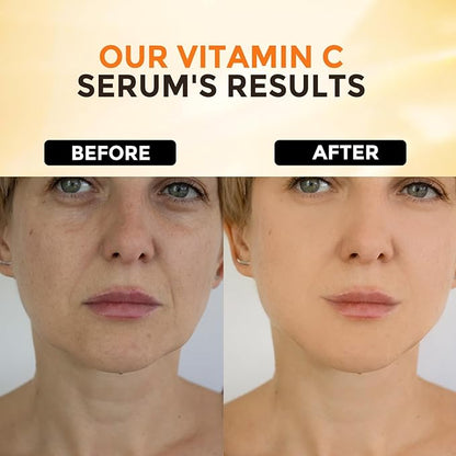 2 Packs Vitamin C Serum for Face –Anti Aging Face & Eye Serum, Hyaluronic Acid, Reduce Fine Lines, Dark Spots and Wrinkle