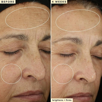 Farmacy 10% Vitamin C Face Serum - Waterless Vitamin C Skin Care Serum to Brighten, Firm + Smooth Skin Texture - Enriched with Upcycled Tangerine Peel to Boost Skin's Moisture + Radiance (5ml)