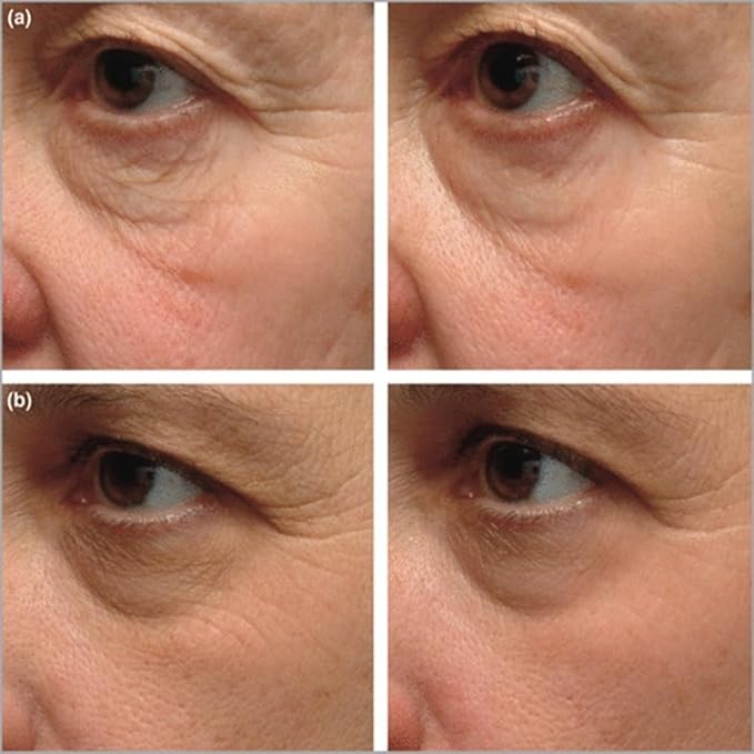 Instant Firming Eye Serum – Targets Under-Eye Bags, Wrinkles, Dark Circles & Fine Lines – Anti-Aging Formula (15ml / 0.49 oz)