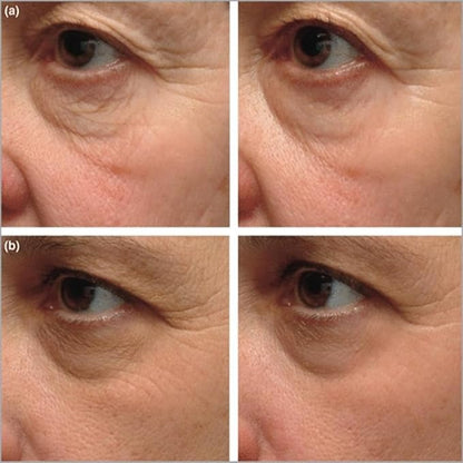 Instant Firming Eye Serum – Targets Under-Eye Bags, Wrinkles, Dark Circles & Fine Lines – Anti-Aging Formula (15ml / 0.49 oz)
