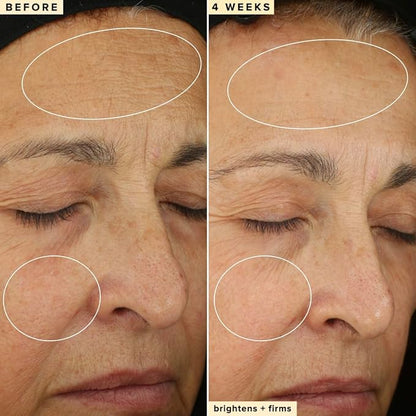 Farmacy 10% Vitamin C Face Serum - Waterless Vitamin C Skin Care Serum to Brighten, Firm + Smooth Skin Texture - Enriched with Upcycled Tangerine Peel to Boost Skin's Moisture + Radiance (30ml)