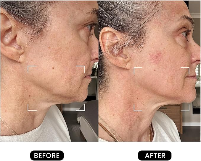 Revive Skincare for Anti-Aging, Glow Like Never Before,Multifunctional Beauty Device, Facial Massager for Home Use