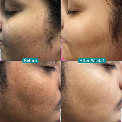 10% Vitamin C Face Serum | Anti Aging Facial Serum with 5% Niacinamide & Kakadu Plum | Reduces Fine Lines, Smooths Skin Texture & Improves Radiance | 1.01 Fl Oz (30ml)