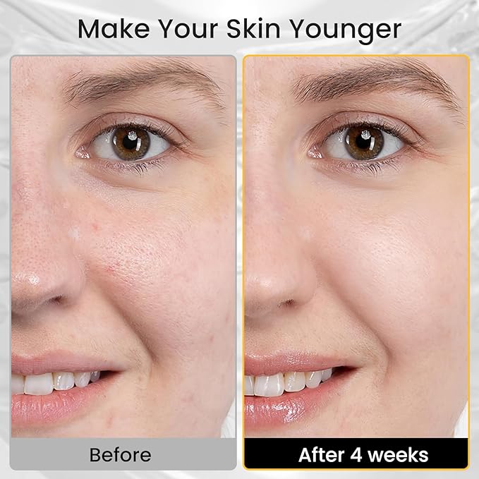 Red Light Therapy for Face - 4 Colors LED Face Mask Light Therapy with Timing Function, LED face Mask Light Therapy at Home 240 LED Beads (White+Silver)