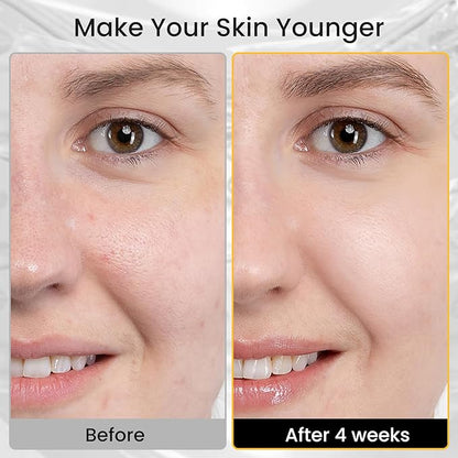 Red Light Therapy for Face - 4 Colors LED Face Mask Light Therapy with Timing Function, LED face Mask Light Therapy at Home 240 LED Beads (White+Silver)