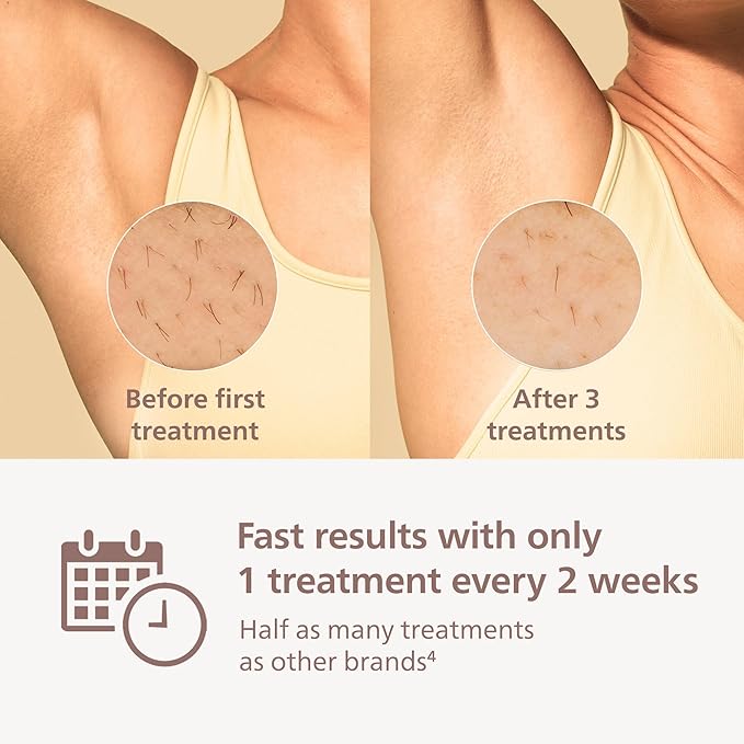 Philips Lumea 9000 Series IPL Hair Removal Device - Alternative to Laser Hair Removal, SenseIQ Technology and Lumea App, 4 Attachments for Body, Face, Bikini & Underarms, for Women & Men, BRI984/03