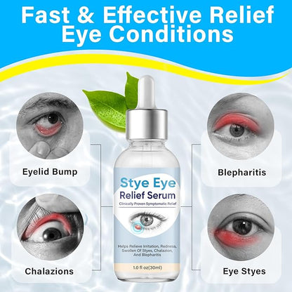 Stye Eye Treatment, Natural Stye Treatment Serum for Styes Chalazion and Blepharitis, Mild & Fast Relief