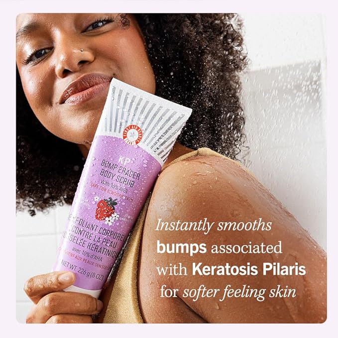 First Aid Beauty - KP Bump Eraser Body Scrub with 10% AHA, Keratosis Pilaris Exfoliator with Glycolic and Lactic acids, Helps Reduce Chicken Skin Bumps, Safe for Sensitive Skin, Strawberry Scent, 8 oz