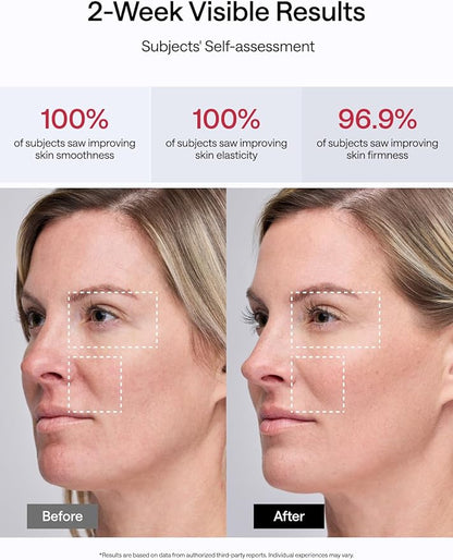 JMOON NouvelleSkin Facial Toning Device, FDA-Cleared Microcurrent Facial Device and Red Light Therapy for Face, 4 Modes & 5 Intensity Levels for Personalized Face Lift & Smoothing. M30U PR