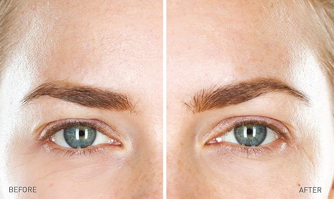 Transformulas Marine Miracle EyeZone Advanced Eye Concentrate, Lightweight Cream, Minimises Wrinkels, Smoothens Skin 11.4ml