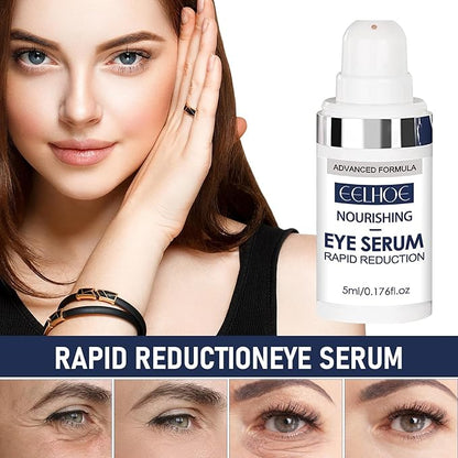 Rapid Reduction Eye Serum, Anti Aging Serum Visibly Reduces Under-Eye Bags, Sunlit Rose- Satin Finish, Nourishing Eye Serum, Suitable For All Skin Type(2PCS)