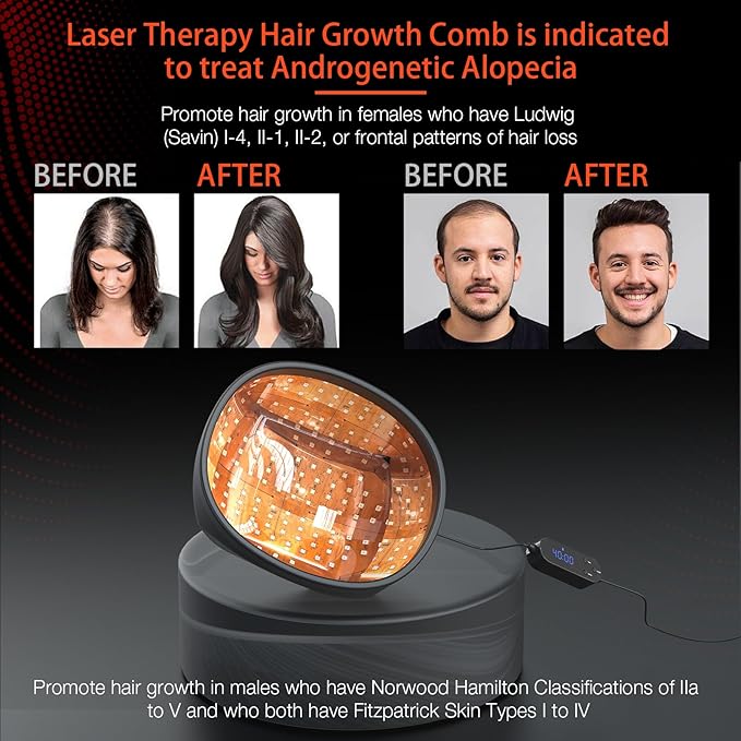 Laser Cap (FDA Cleared), Professional Medical Grade Lasers Hair Growth Treatment Product for Men & Women, Red Light Therapy for Hair Growth, Treat Alopecia