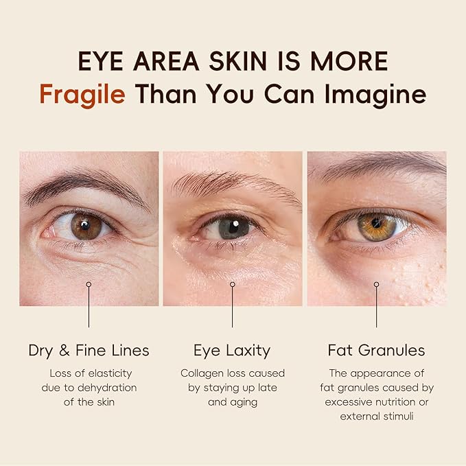 Easilydays Vitamin C Eye Cream & Under Eye Serum, Refreshing, Hydrating, Radiant Glow Eye Care Eye Roller Serum with 360° Massage Ball, Tightening Under Eye Serum for Women Reduce Wrinkles Fine Lines