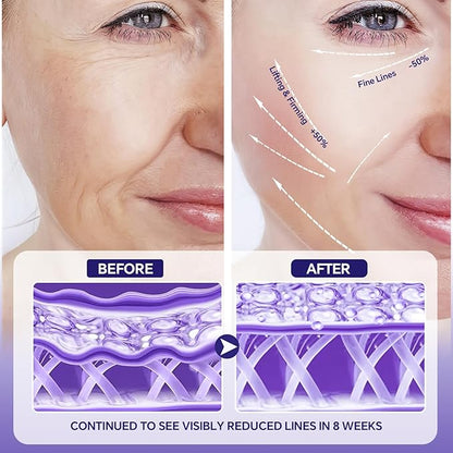 Peptides Serum for Face with Hyaluronic Acid for Fine Lines and Wrinkles, Collagen Boosting Hydrating Face Serum, Anti-aging for All Skin Types, Fragrance Free, 1.35 Fl. Oz