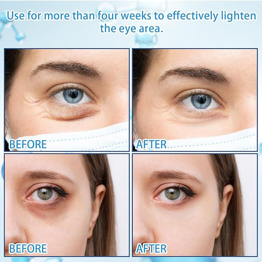 5% Caffeine Eye Serum with 360° Massage Rollerball Topper,Caffeine Cream for Dark Circles,Wrinkles,Puffiness and Fine Lines,Under Eye Roller Cream Treatment for Women and Men