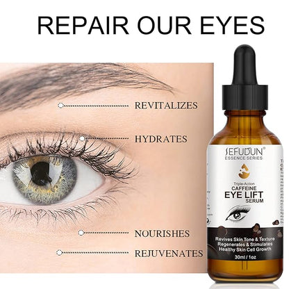 Caffeine Eye Serum + EGCG, Eye Serum for Dark Circles and Puffiness, Under Eye Serum Reduces Puffiness, Dark Circles, Under Eye Bags, Wrinkles and Fine Lines Around The Eyes, Under Eye Serum 30ml