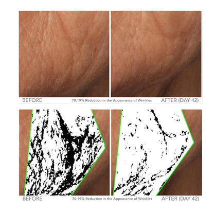 Serious Skincare - Beyond Intensive Vitamin C Serum for Face & Neck - 60 Day Facial Treatment to Brighten & Revive Glow - Visibly Smooth Lines, Wrinkles and Pores - AM & PM 2 Piece Skin Care Set