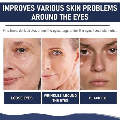 Rapid Reduction Eye Serum, Anti Aging Serum Visibly Reduces Under-Eye Bags, Sunlit Rose- Satin Finish, Nourishing Eye Serum, Suitable For All Skin Type(2PCS)