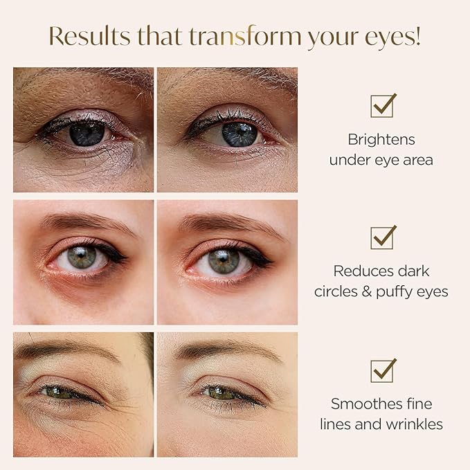 PLANTIFIQUE Korean Vitamin C Face Massage Serum and Gold Under Eye Patches for Puffy Eyes and Dark Circles 5 Pairs