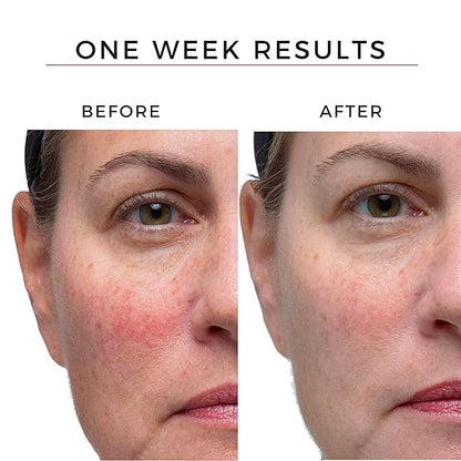 Hey Honey Good Morning Honey Silk Facial Serum | Anti-Aging Vitamin C & Hyaluronic Acid Serum for Radiant Skin Boosts Glow, Smooths Fine Lines, Strengthens Skin Barrier | 1 oz