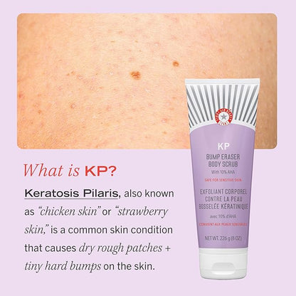 First Aid Beauty - KP Bump Eraser Body Scrub with 10% AHA, Keratosis Pilaris Skin Exfoliater with Glycolic and Lactic acids, Helps Reduce Chicken Skin Bumps, Safe for Sensitive Skin, 8 oz + Bonus, 2ct