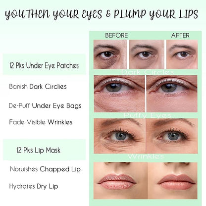 CCbeauty 24 Packs Lip Masks & Eye Mask Bulk,24K Gold Under Eye Patches for Puffy Eyes,Dark Circles,Collagen Eye gel Pads for Eye Bags,Wrinkles | Nourish & Hydrate Dry Chapped Lips Skincare, Pink