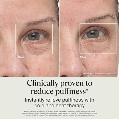 Therabody TheraFace Depuffing Wand – Cold and Heat Skincare Treatment to Depuff and Glow; Beauty Wand, Face Roller and Eye Massager for Eye Puffiness, Dark Circles and Skin Radiance (White)