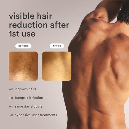 NEW Nood™ Flasher Pro — IPL Laser Hair Removal Device for Women & Men with Sapphire Cooling — Pain-free & Permanent, Visible Results After First Use & Works Everywhere Hair Grows — Gloss White