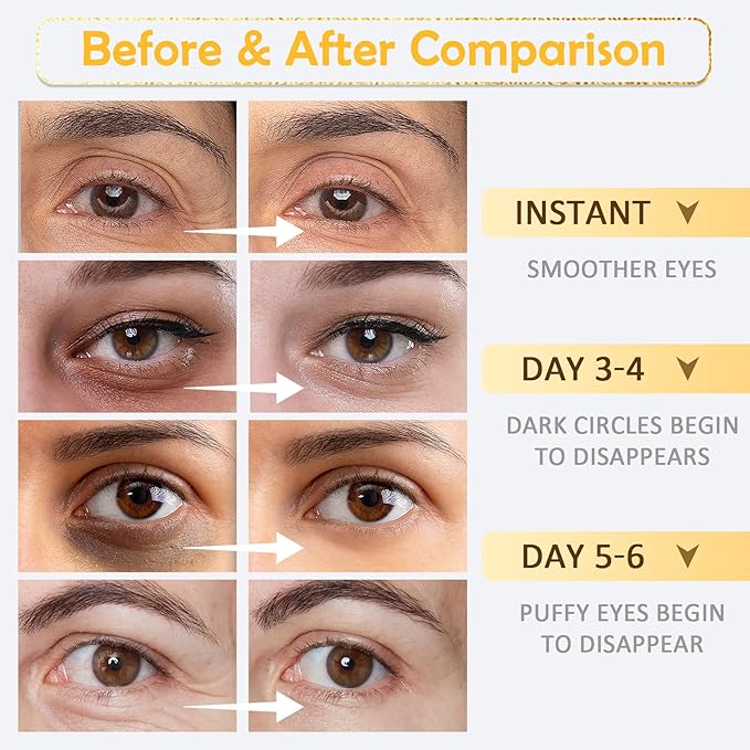 30 Pairs of Eye Masks and 10 Pairs of Lip Masks Skincare Gift Set,Moisturizing Lip Patches and Under Eye Patches for Women Eye Lip Care,Hydrating Gold Eye Patches and Lip Sheet Masks Skin Care Set