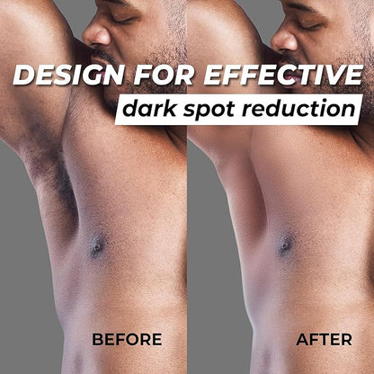 Combo exclusively for men Abera Eye Roller Serum With Mint Essence - Abera Armpit Roller