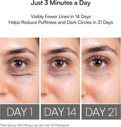 INIA Under-Eye Red Light Therapy for Face, 4-in-1 Beauty Device with Heat, Vibration, Massage & Red Light for Dark Circles, Puffiness & Skin Firming – Enhances Skincare Routine