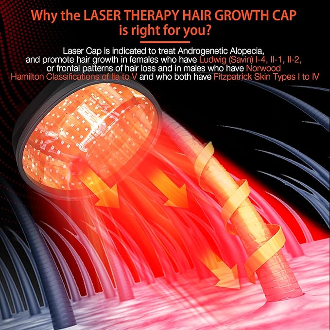 Laser Cap (FDA Cleared), Professional Medical Grade Lasers Hair Growth Treatment Product for Men & Women, Red Light Therapy for Hair Growth, Treat Alopecia