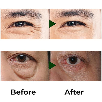 Abera Eye Roller Serum with Mint Essence for Men, Vitamin C and Peptides - Energizing Serum for Dark Circles and Puffiness, Fine Lines Serum, 0.34 fl oz (B. 2 Boxes)