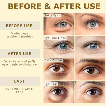 Gold Under Eye Patches-60 Pcs Eye Masks | Anti-Aging |Boost Lift & Firm the Look of the Eye Area |Eye Patches for Puffiness,Bags,Dark Circles (60 Count (Pack of 1), Under Eye Patches)